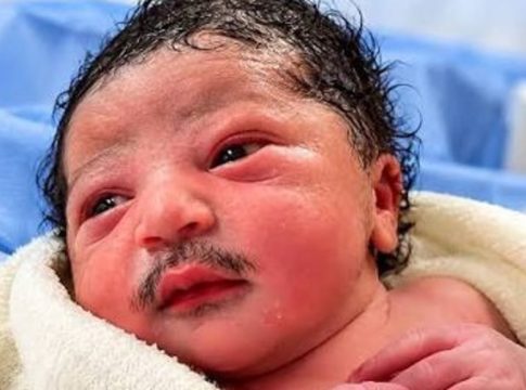 baby-born-with-Beard And Moustache
