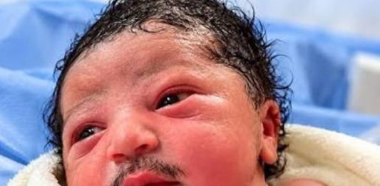 baby-born-with-Beard And Moustache