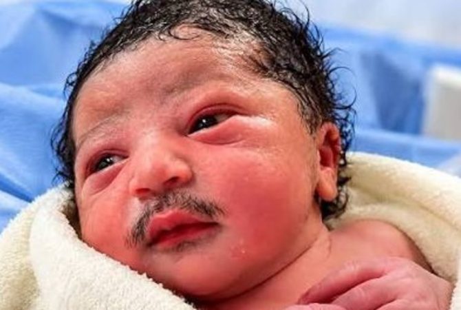 baby-born-with-Beard And Moustache